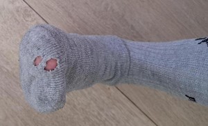 Der Nagel ging auch zweimal durch meine Socke